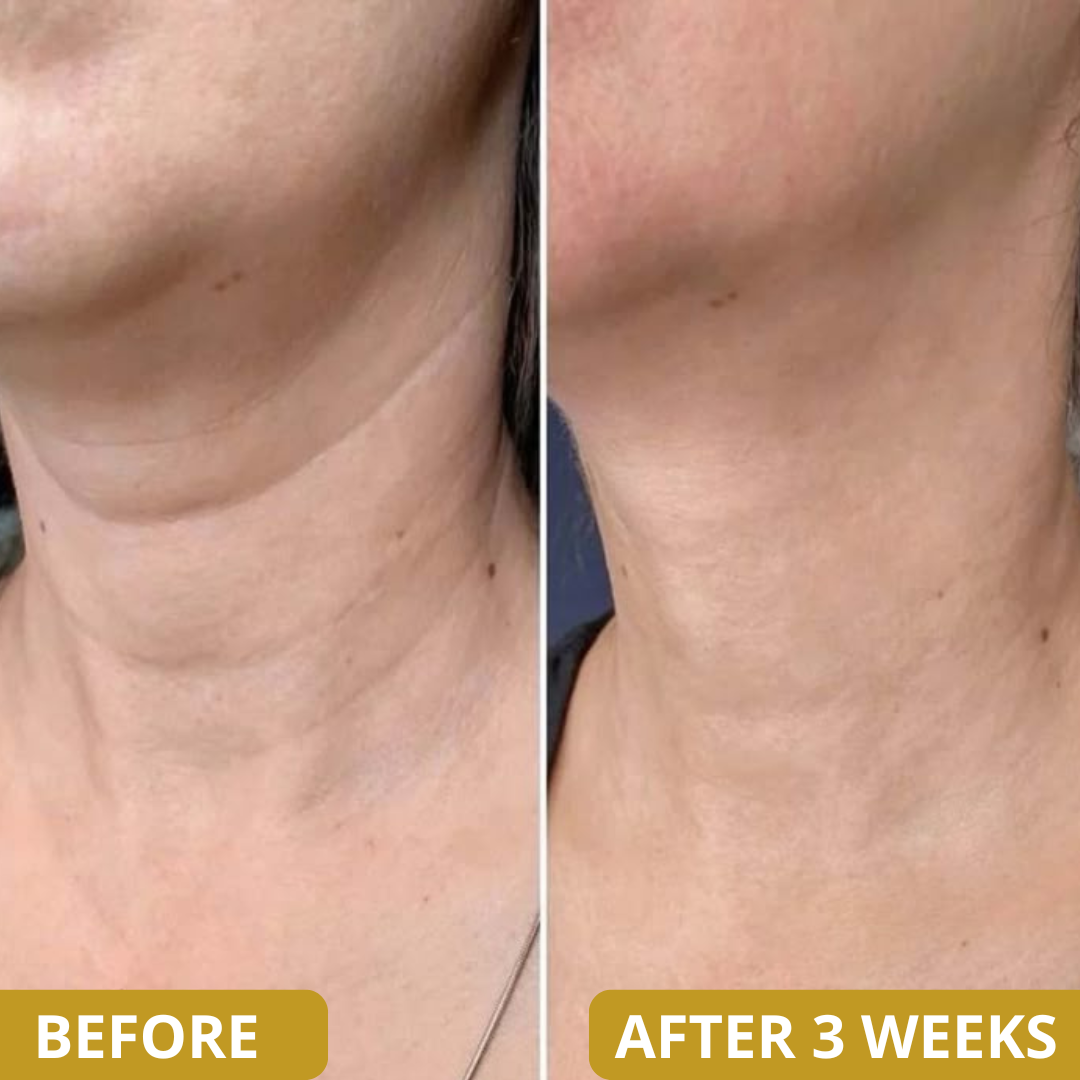 Neck Sculpt Firming Cream – Tighten, Lift & Restore Youthful Skin