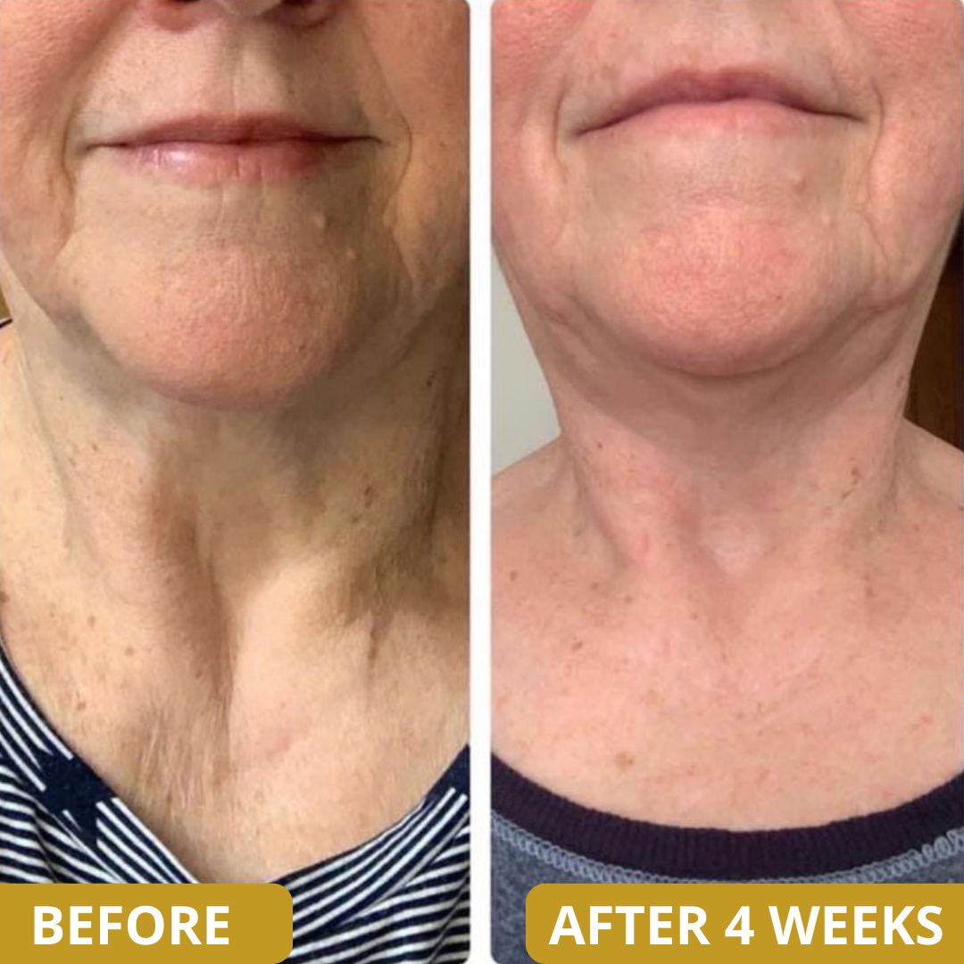 Neck Sculpt Firming Cream – Tighten, Lift & Restore Youthful Skin