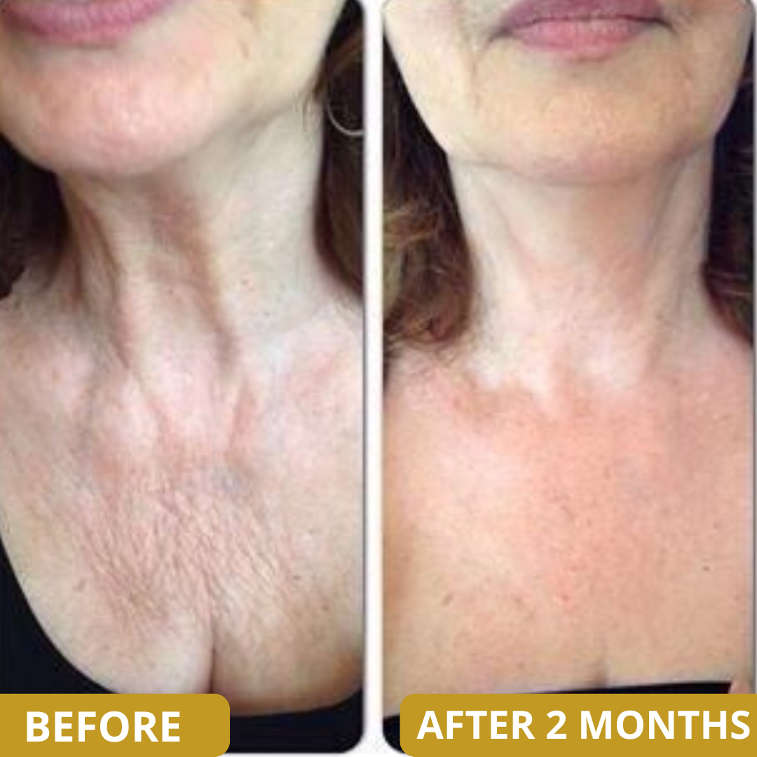 Neck Sculpt Firming Cream – Tighten, Lift & Restore Youthful Skin