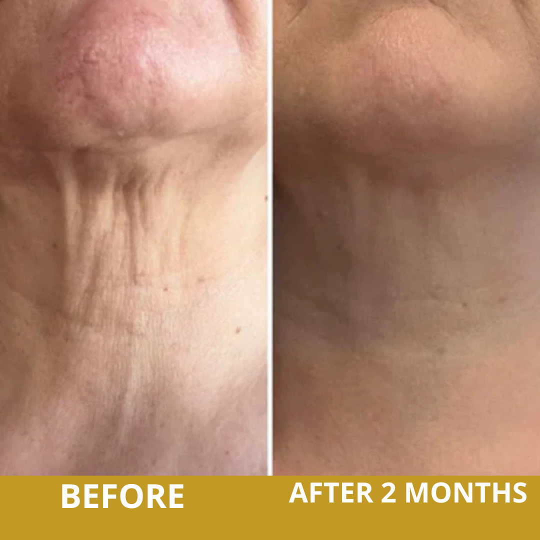 Neck Sculpt Firming Cream – Tighten, Lift & Restore Youthful Skin