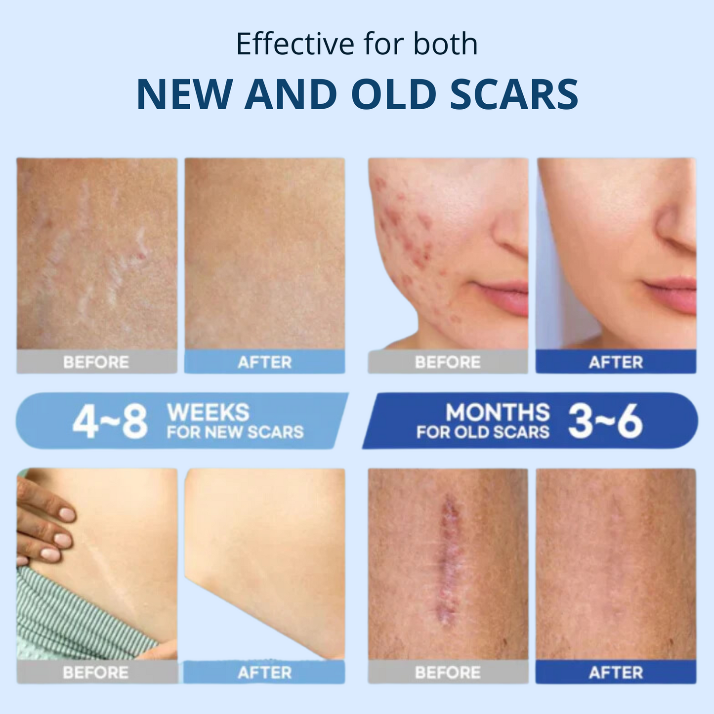 Premium Scars&Wrinkles Tape