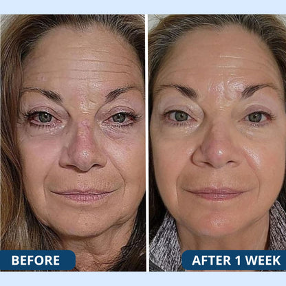 Premium Scars&Wrinkles Tape