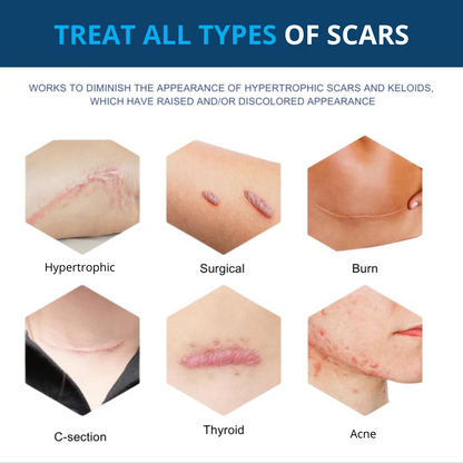 Premium Scars&Wrinkles Tape