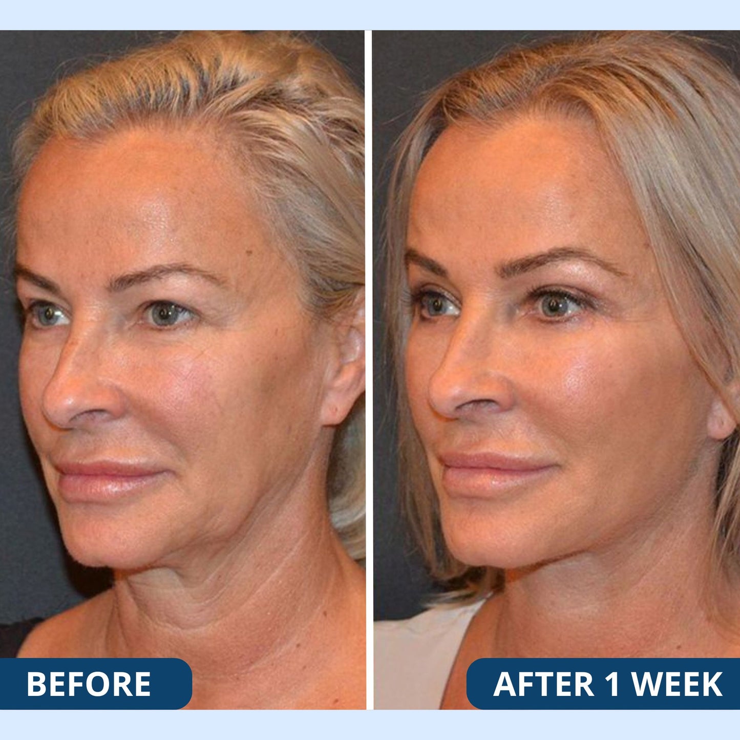 Premium Scars&Wrinkles Tape